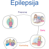 Epilepsija: Ana Sruk